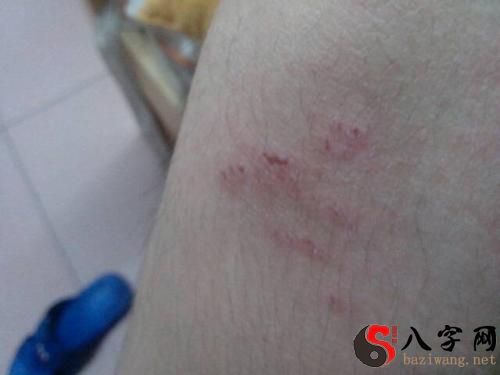 夢見被老鼠咬腿