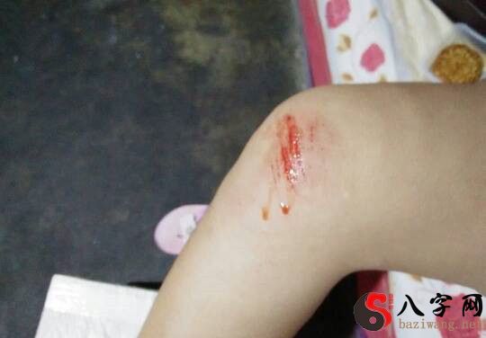 夢見兒子摔下樓梯流血了